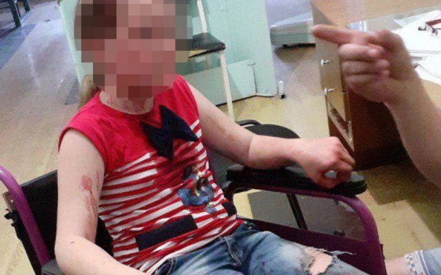 На Днепропетровщине в тире выстрелили девочке в лицо Фото № 0 На Днепропетровщине в тире выстрелили девочке в лицо Фото № 0
