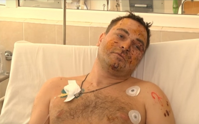 В Днепре спасают раненого под Мариуполем полицейского Фото № 0 В Днепре спасают раненого под Мариуполем полицейского Фото № 0