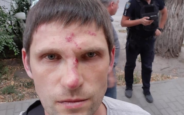 В Днепре двое мужчин избили известного активиста Фото № 0 В Днепре двое мужчин избили известного активиста Фото № 0