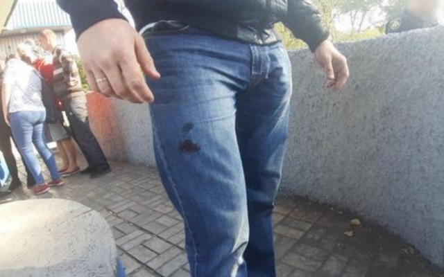 На Днепропетровщине грабитель ударил полицейского заточкой в ногу Фото № 1 На Днепропетровщине грабитель ударил полицейского заточкой в ногу Фото № 1
