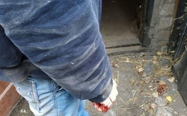 ЧП на Днепропетровщине: мужчина пытался покончить с собой в сарае Фото № 0 ЧП на Днепропетровщине: мужчина пытался покончить с собой в сарае Фото № 0