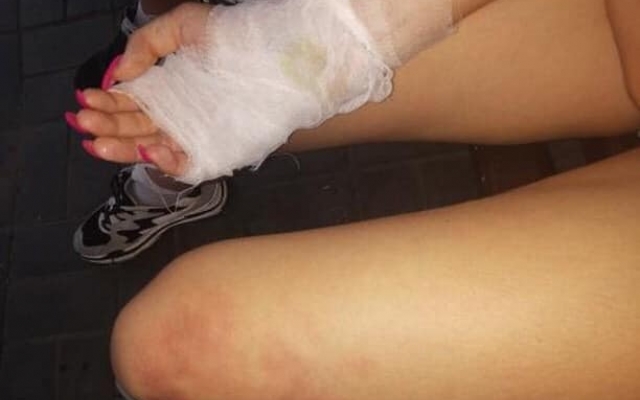 На Днепропетровщине девочка упала в костер Фото № 0 На Днепропетровщине девочка упала в костер Фото № 0