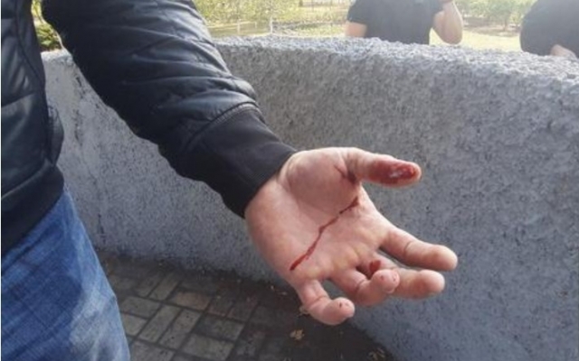 На Днепропетровщине грабитель ударил полицейского заточкой в ногу Фото № 0 На Днепропетровщине грабитель ударил полицейского заточкой в ногу Фото № 0