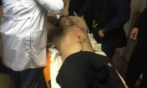 Врачи больницы Мечникова прооперировали убийцу патрульных