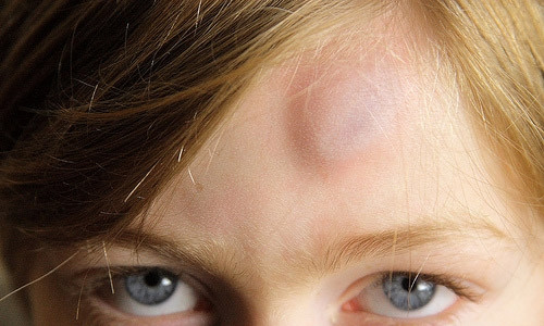 Нападение на девочку в Днепре: ребенка хотели оглушить ударом по голове