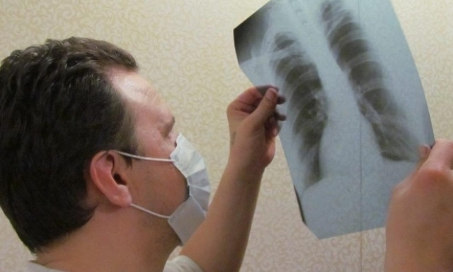На Днепропетровщине готовятся к месячнику по борьбе с туберкулезом 