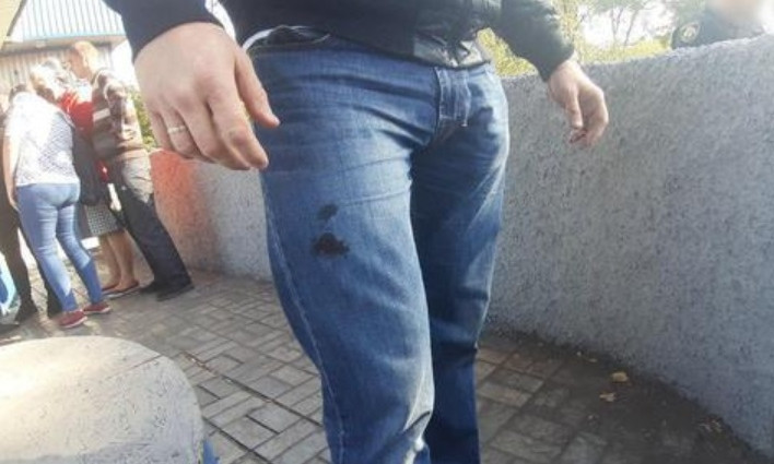 На Днепропетровщине грабитель ударил полицейского заточкой в ногу 