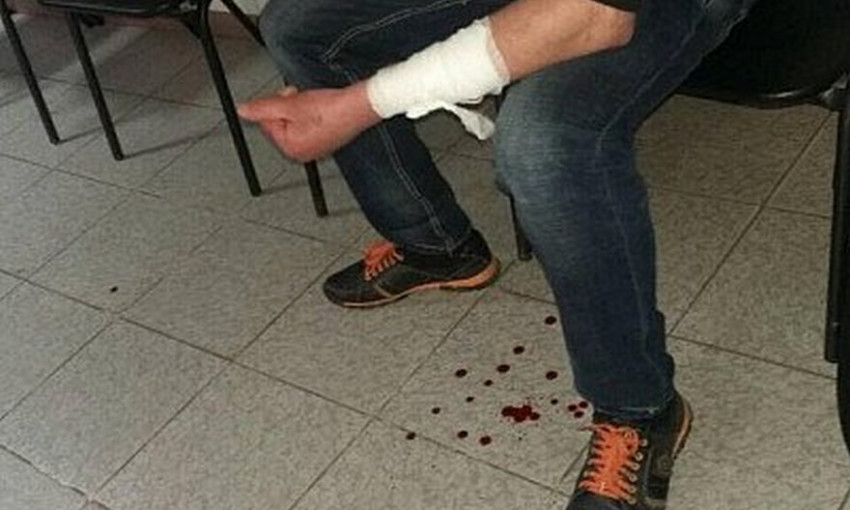ЧП на Днепропетровщине: мужчина вскрыл вены в отделении полиции