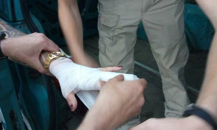 ЧП в Днепре: горожанин защемил пальцы сотруднице полиции 