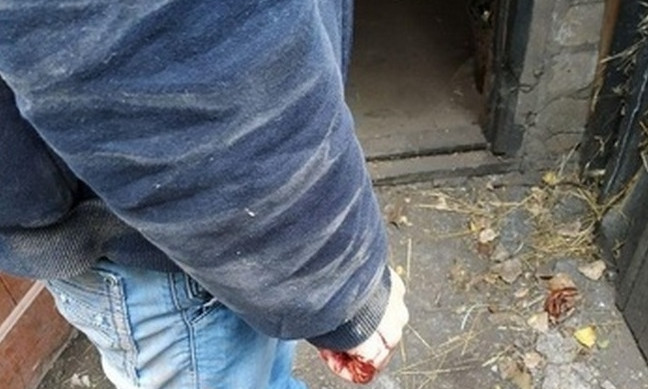 ЧП на Днепропетровщине: мужчина пытался покончить с собой в сарае