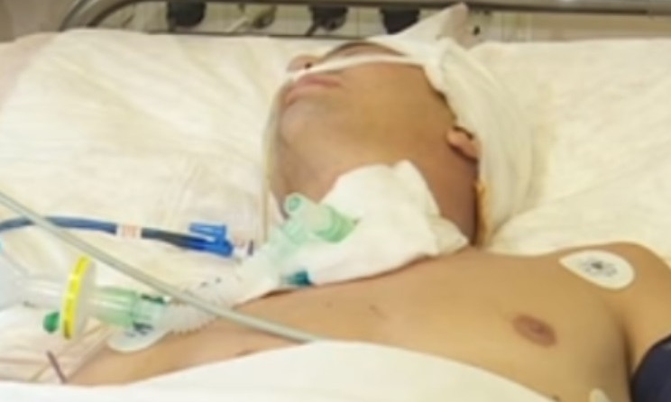 Врачи Мечникова сделали трепанацию черепа раненому бойцу 