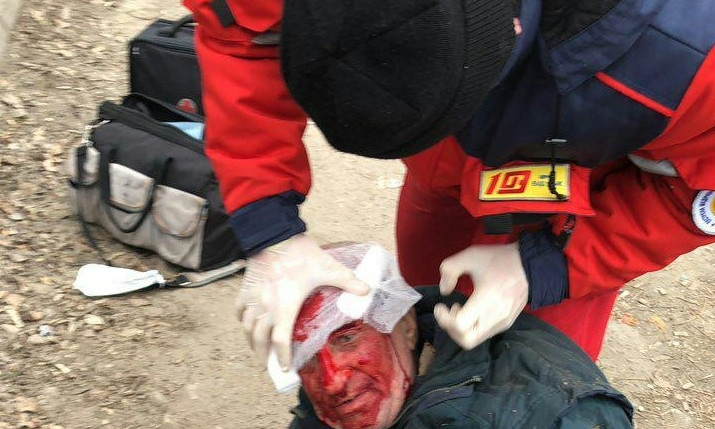 ЧП в Днепре: мужчина упал и разбил голову