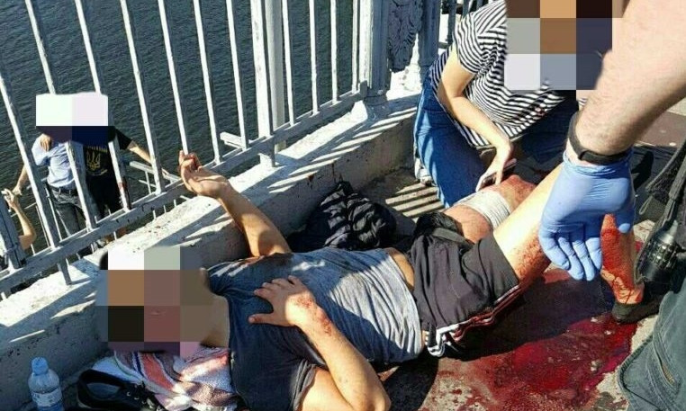 ЧП в Днепре: мужчину ранили на пешеходном мосту к Монастырскому острову