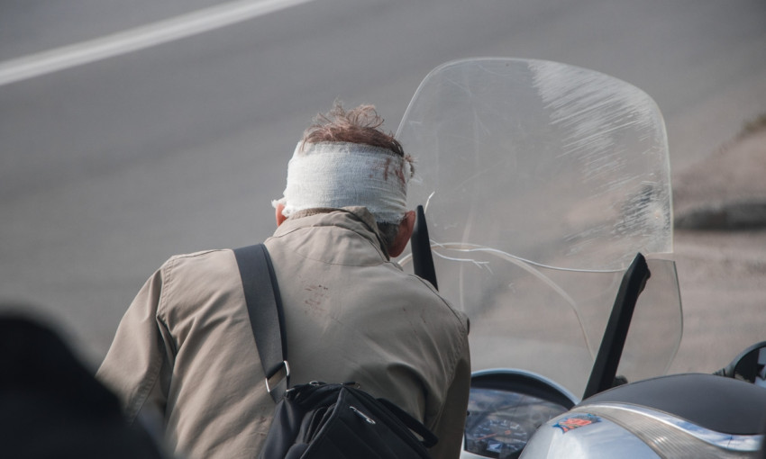 ДТП в Днепре: на улице Передовой скутер сбил 17-летнего парня