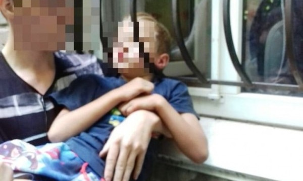 ЧП на Днепропетровщине: мальчик застрял головой в решетке 