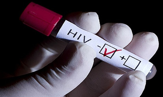 Днепряне сделают тесты на выявление ВИЧ прямо на улице 