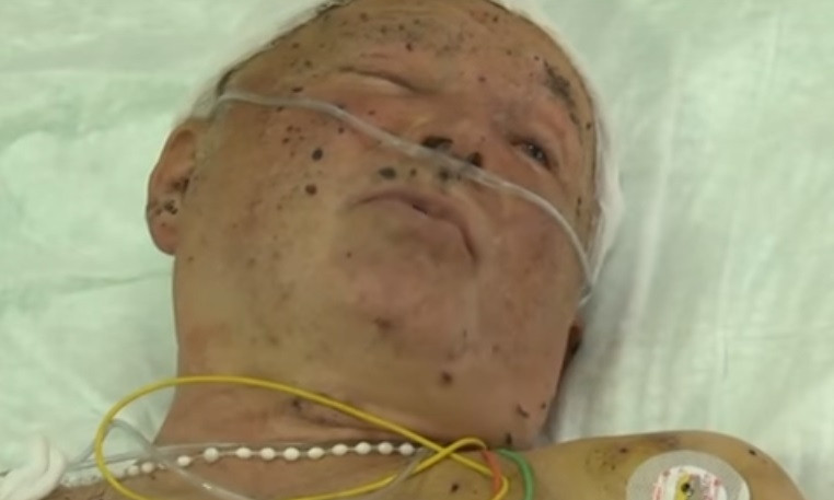В больнице Днепра пришел в сознание раненый боец 