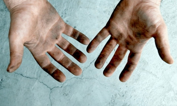 Болезнь грязных рук: на Днепропетровщине ожидается вспышка болезни Боткина