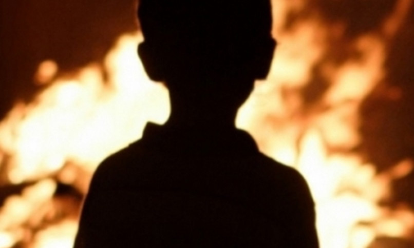 В Днепре подожгли ребенка: как чувствует себя 8-летний мальчик