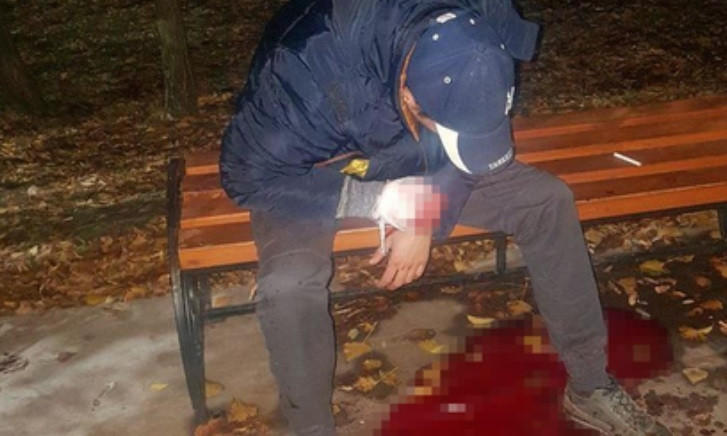 ЧП на Днепропетровщине: мужчина порезал вены на улице 