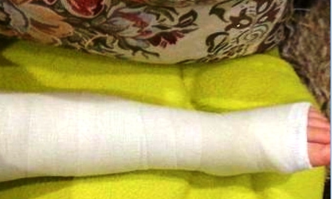 На Днепропетровщине ребенок сломал ногу на мягкой горке